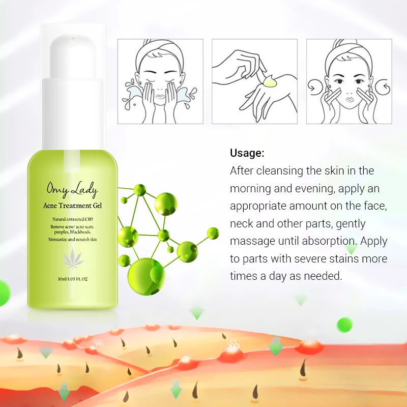 OMY LADY wholesale korea acne scar removal face anti acne whitening cream