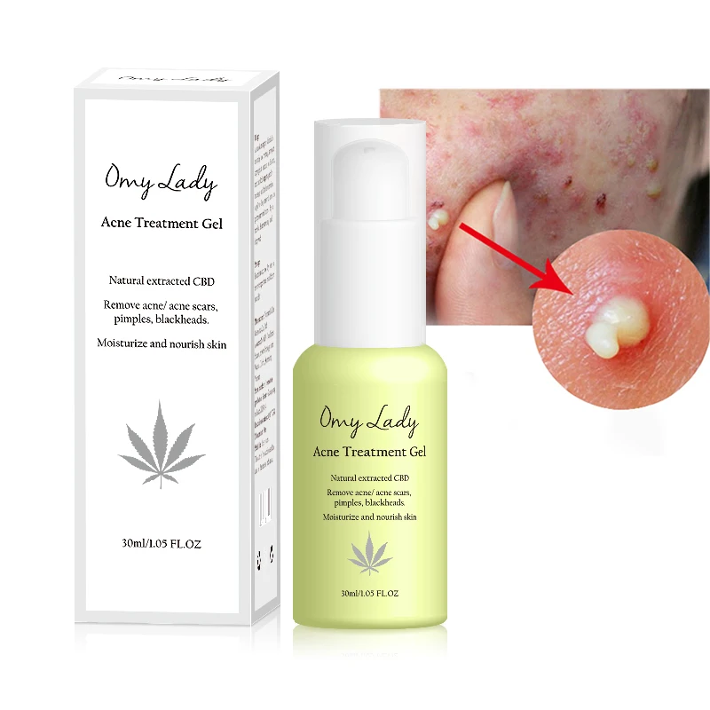 OMY LADY wholesale korea acne scar removal face anti acne whitening cream