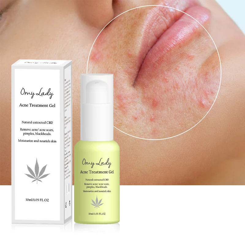 OMY LADY wholesale korea acne scar removal face anti acne whitening cream